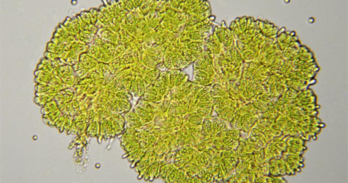 Forget palm oil and soya, microalgae is the next big biofuel source