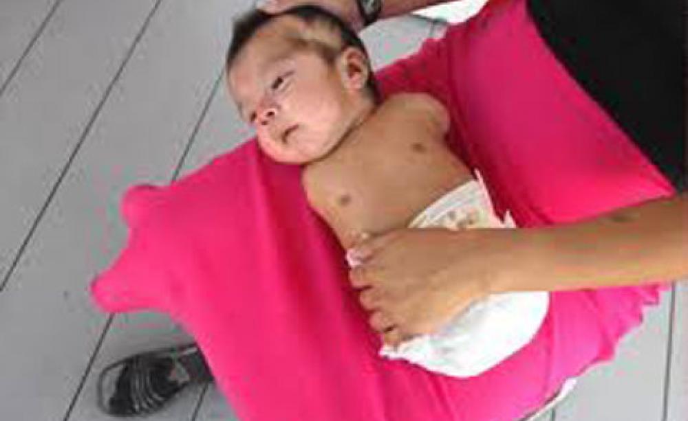 Chemical Warfare The Horrific Birth Defects Linked To Tomato Pesticides Chemical Warfare The Horrific Birth Defects Linked To Tomato Pesticides