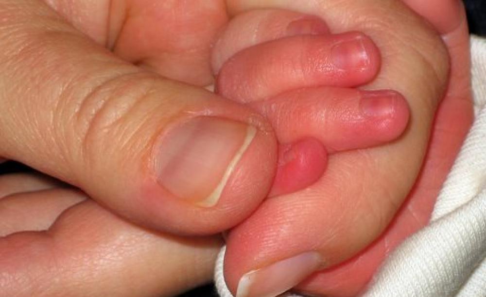 Photo: Lisa Ruokis via Flickr, CC BY-NC-ND 2.0.