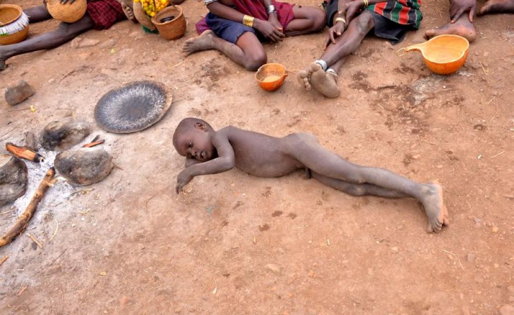 A Mursi boy suffering from Malaria in Ethiopia's Omo Valley. With warming, the range of malaria-carrying mosquitos will extend up into the Highlands. Photo: Rod Waddington via Flickr (CC BY-SA).
