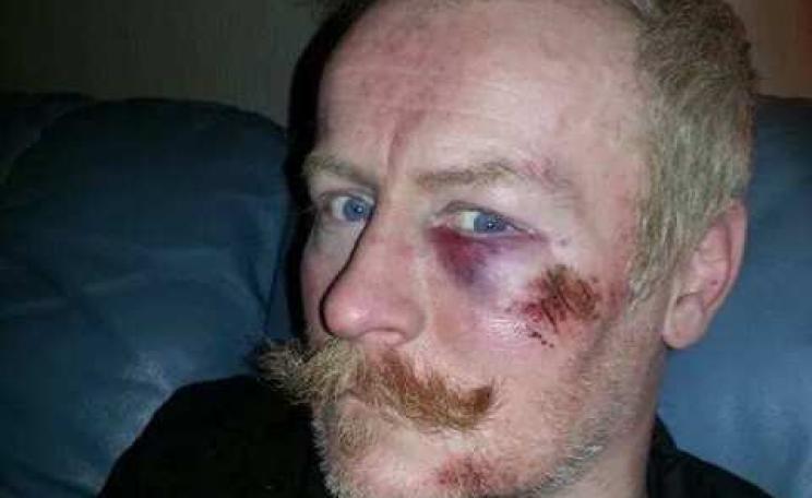 Chris O'Donnell after being attacked by police.