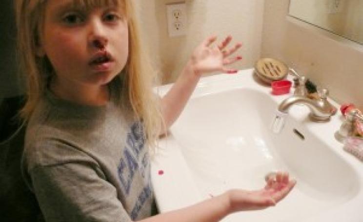 Emma Parr and her father Bob began having nosebleeds after moving in to a home surrounded by gas wells. Photo: Earthworks / www.earthworksaction.org/ .