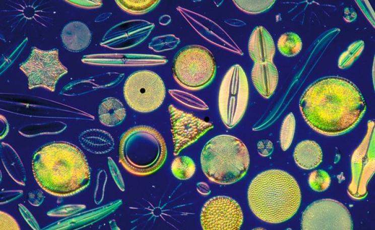 As ocean acidity rises, diatoms stuggle to gow in variable light conditions. Photo: Mixed diatom frustules by Carolina Biological Supply Company via Flickr (CC BY-ND-NC 2.0).