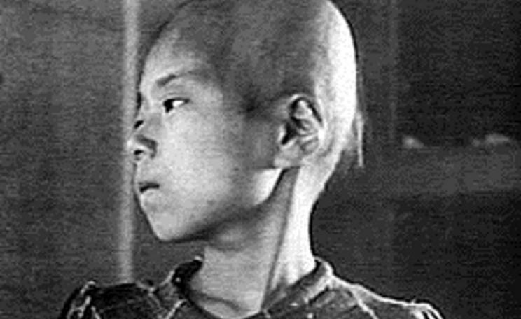 Aiko Ikemoto on 6th October 1945, as an outpatient at Hiroshima Red Cross Hospital. Shielded from the blast by brick walls, she survived the explosion a few miles from its epicentre, but died of cancer on 21st January 1965 at the age of 29 shortly after g